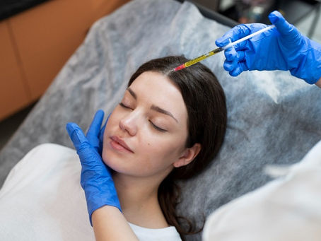 Proven Benefits Of PRP Injections For Hair Growth