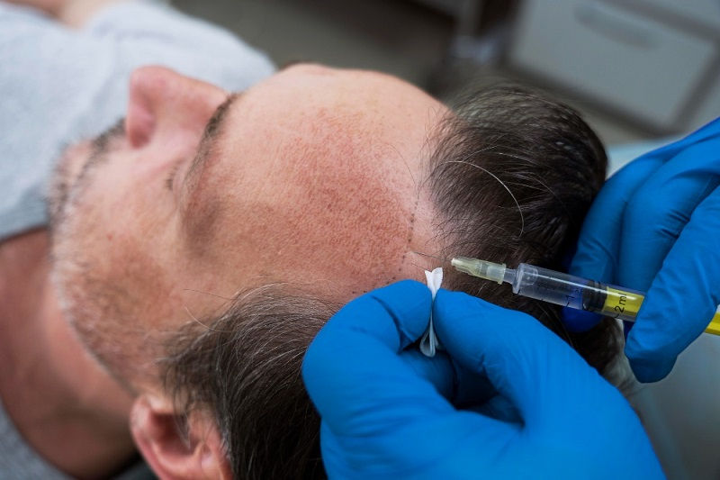 prp injections gold coast