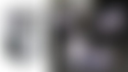 Metropolitan General: Αναγεννητική Ιατρική με τεχνολογία αιχμής!