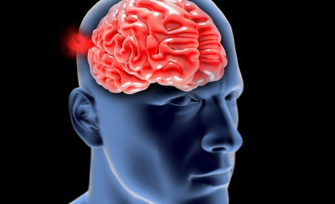 Ανεύρυσμα εγκεφάλου: Τι είναι, συμπτώματα, θεραπεία