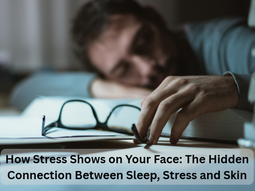 How Stress Shows on Your Face: The Hidden Connection Between Sleep, Stress and Skin