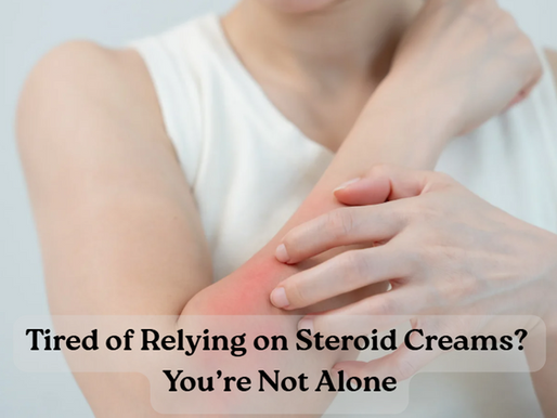 Tired of Relying on Steroid Creams? You’re Not Alone