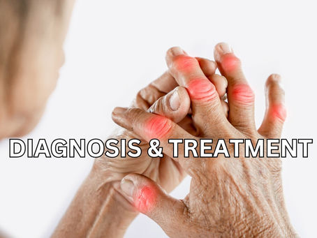 Navigating the Diagnosis and Treatment of Pseudogout