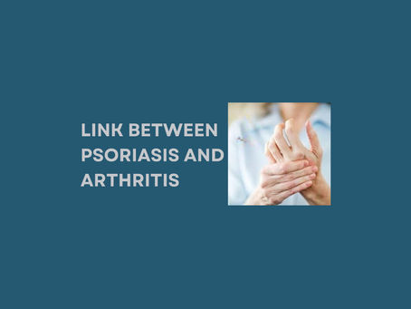 Exploring Links Between Psoriasis and Arthritis