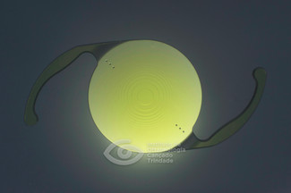 Lentes intraoculares alcon sn60wf new arrivals