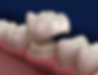 crowns.jpg.webp