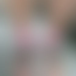 こんな施術をしています。#1 30代男性