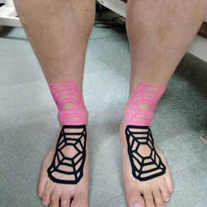 こんな施術をしています。#1 30代男性