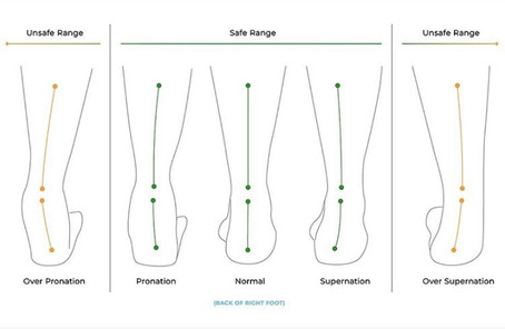 WHAT IS PRONATION, OVERPRONATION AND SUPINATION?