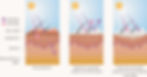 3 panels, each showing a section of skin and how it is affected by sun rays with no protection, mineral sunscreen protection and chemical sunscree protection
