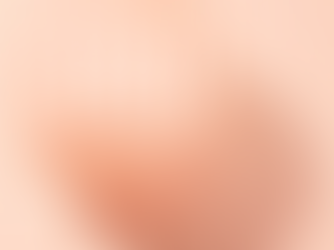 SIBO - gas, bloating, or IBS?