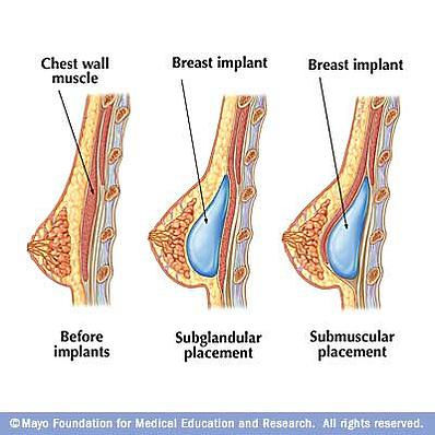 John Diaz, MD Breast Augmentation Specialist