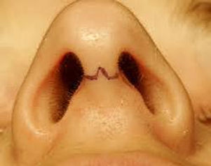 Dr. John Diaz Breast Rhinoplasty Specialist