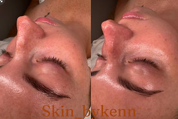 Skin_bykenn - 2.jpeg