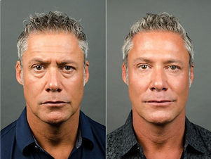 Ken Before and After_0.jpg