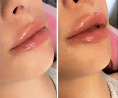 42194042_2677338229157094_82151188691618