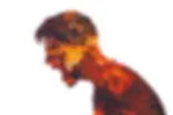 The side profile of a man with fire inside as he is expressing anger and frustration due to his chronic pain affecting his mental health