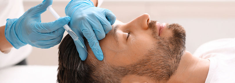 Man receiving medical hair restoration with prp injections at bayshore medical group in annapolis maryland