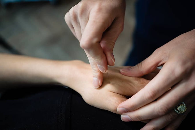 Rebecca-Side-Acupuncture-Hand.jpg