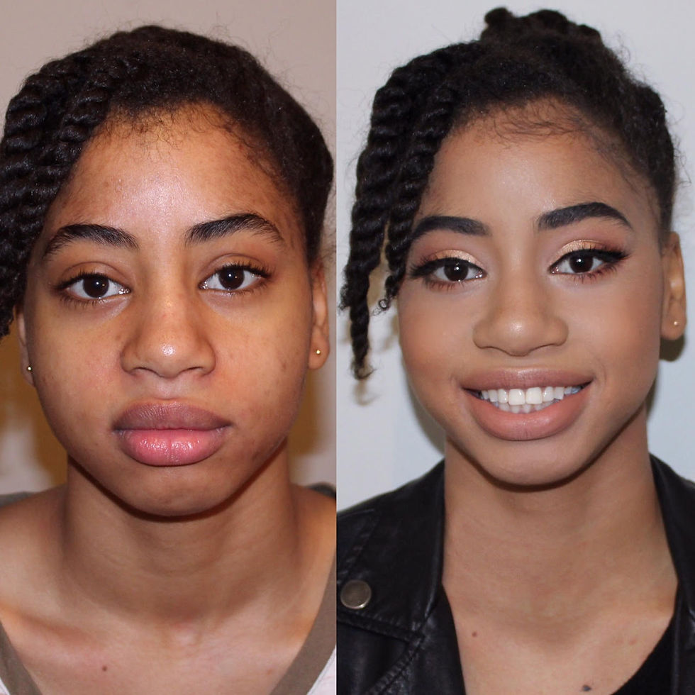 Before & After