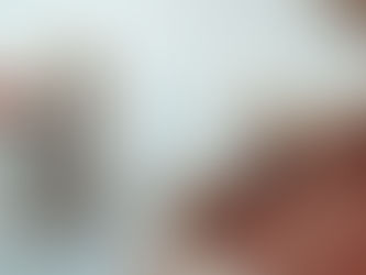 🦷 Implantes Dentários: o Caminho para Recuperar Seu Sorriso com Segurança e Confiança