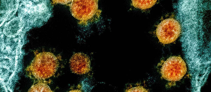 Nuevas cepas de coronavirus: cuántas existen, qué las diferencia entre sí y qué se sabe hasta ahora