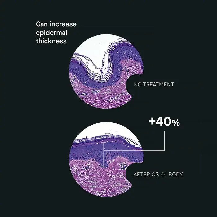 Thumbnail: OS-01 BODY Topical Supplement