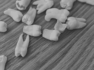 Extracted Wisdom Teeth on a Table