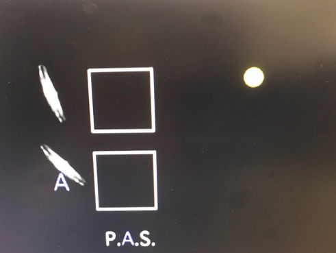 the P A S principle