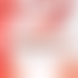 Tudo Sobre a Síndrome dos Ovários Policísticos (SOP)