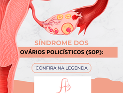 Tudo Sobre a Síndrome dos Ovários Policísticos (SOP)