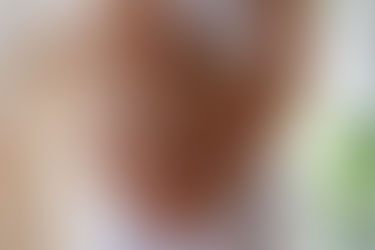 Como prevenir estrias na gestação? 