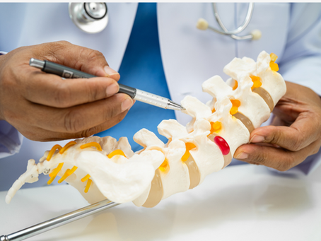 Anatomiczny model kręgosłupa. Fizjoterapeuta w białym fartuchu wskazuje długopisem na czerwony punkt na modelu, symbolizujący problem z dyskiem międzykręgowym.