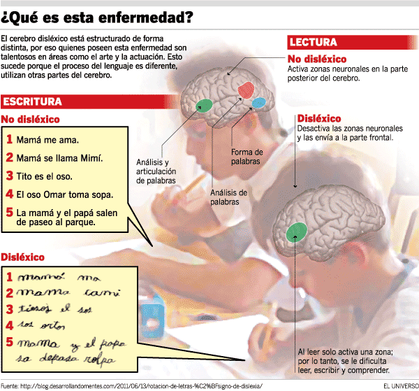 ¿Qué es la dislexia?