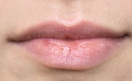 maquillage permanent des lèvres