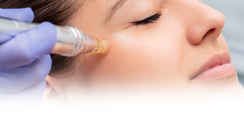 Micro-needling banner copy.png