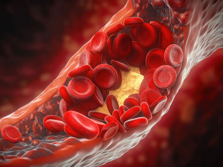 Understanding Vasculitis: Expert Care at Olive Branch Rheumatology