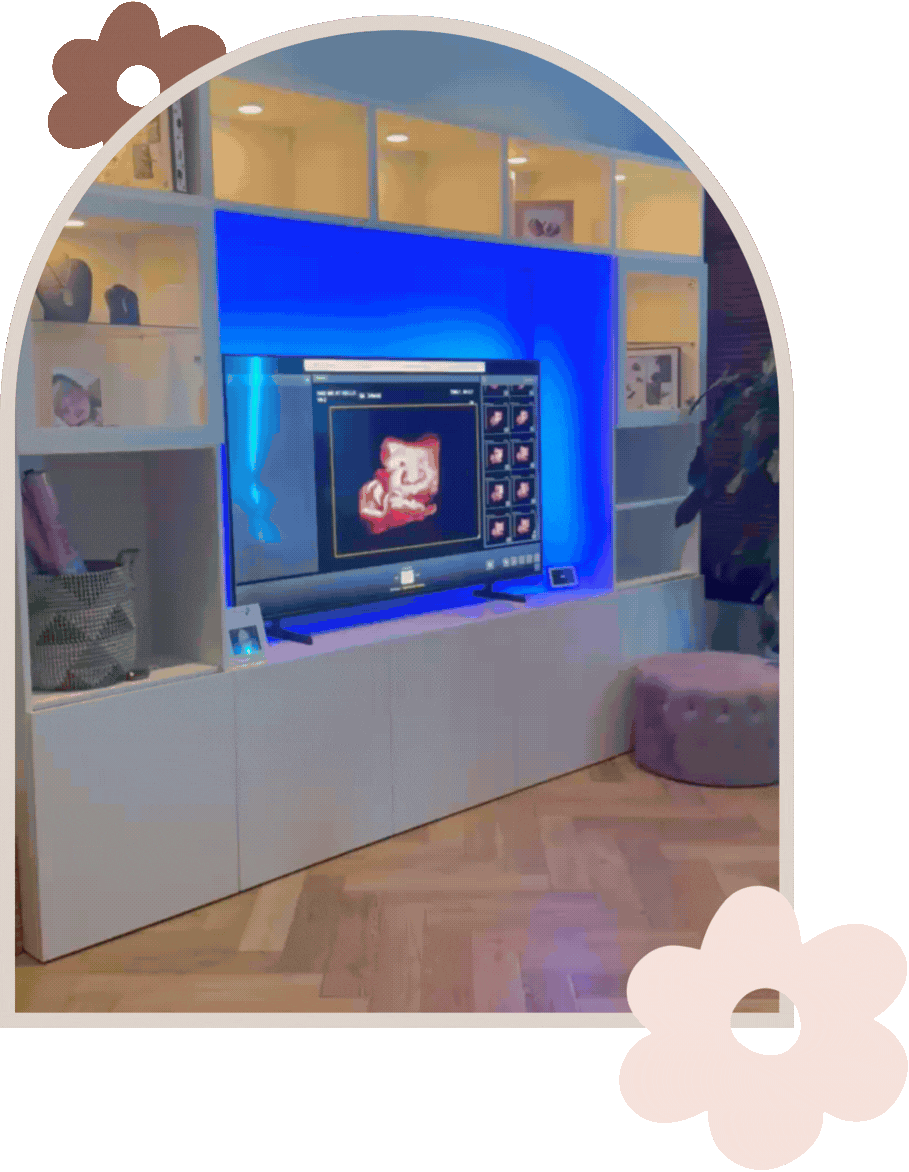 gender reveal scan adelaide hills.gif