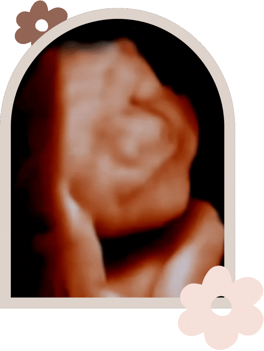 ultrasounds near me.gif