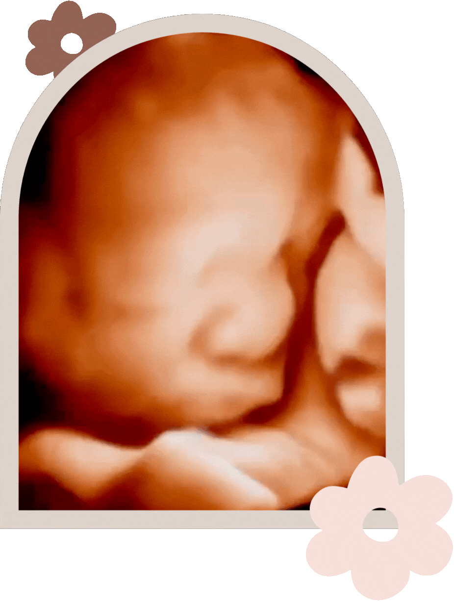 3d ultrasound mawson lakes.gif