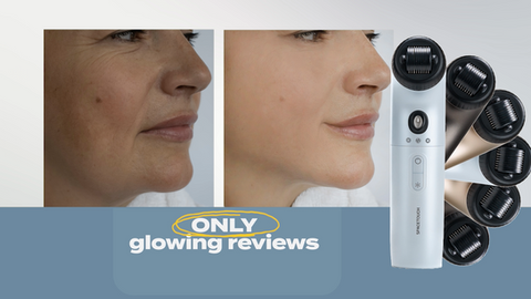 a before and after picture of a woman 's face with the words only glowing reviews