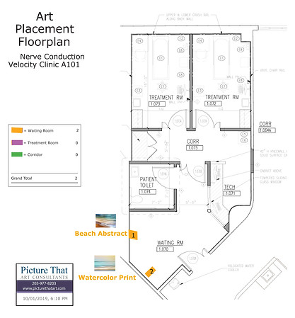 Nerve Conduction Velocity Art Placement