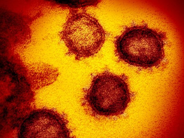 Estudo revela que risco de internação pela Ômicron é menor que a Delta