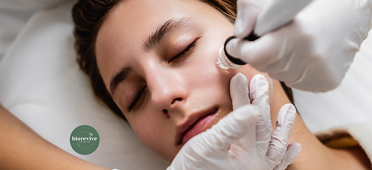 Achieve glowing, refreshed skin with HydraFacial at BioRevive – a non-invasive treatment that deeply cleanses, exfoliates, and hydrates for a smooth, radiant complexion.