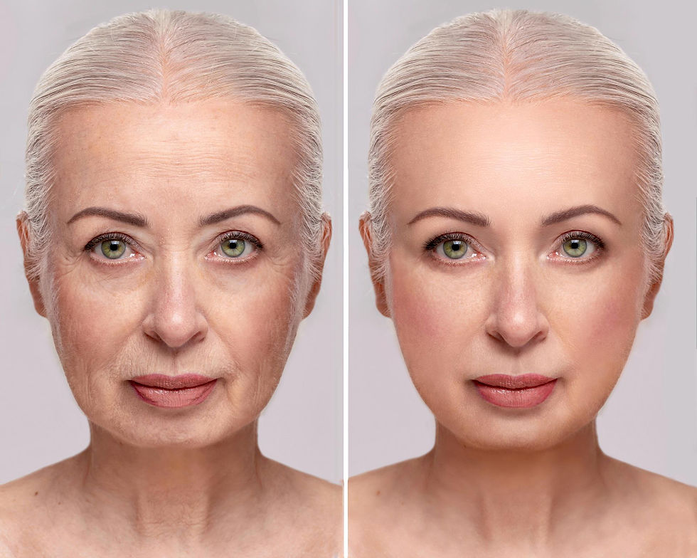 Un avant après d'une femme au niveau du collagène de la peau de son visage