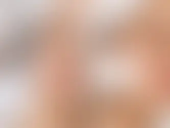 Microneedling ou peeling AHA : lequel choisir ?