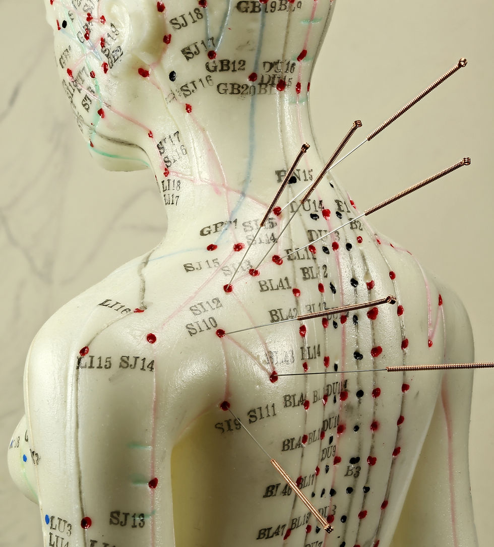 Acupuncture sur les Méridiens