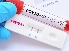 Covid-19: Pernambuco registra 217 novos casos nesta segunda-feira