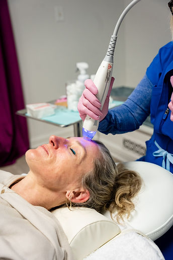 lex-skin-rejuvenation-c02-lasering-lexington-virginia-med-spa.jpg