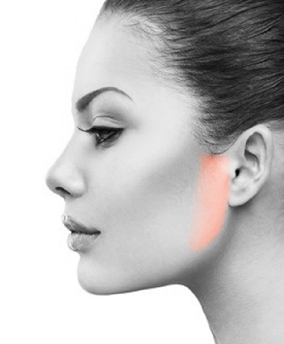 Sideburns Laser Hair Removal for women in NYC